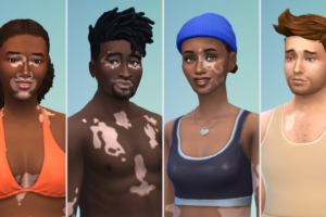 'The Sims 4' adds vitiligo in free update